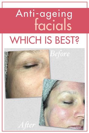 Anti-ageing facial treatments - which is best for you? #antiageing #beauty #over50s