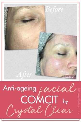 Anti-ageing facial - COMCIT by Crystal Clear - the best non-surgical wrinkle treatment #skincare #over50s